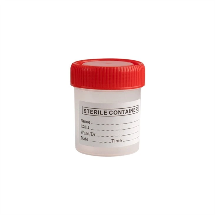 60ml Urine Container (2)
